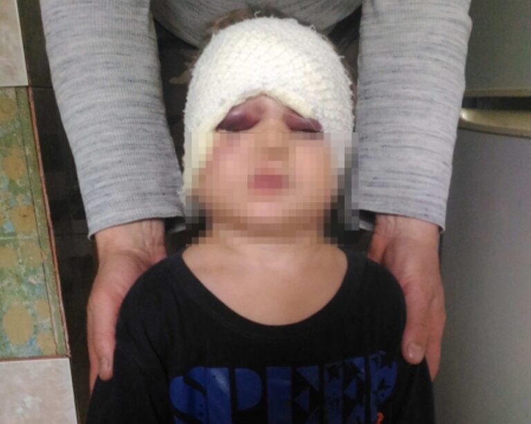 Сожитель волжанки избил ее 3-летнего сына за кусок оторванных обоев